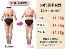 ベルホワイト(Belle White)/【60代前半/4ヶ月の変化】