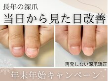 アーティネイルズ(Aaty Nails)