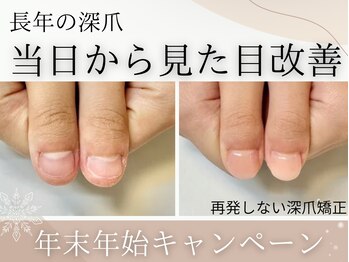 アーティネイルズ(Aaty Nails)