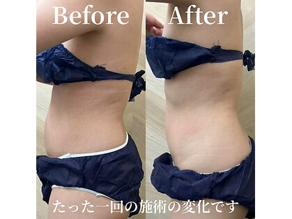 介正鍼灸整骨院 整体院 エフコープ大野城店の写真