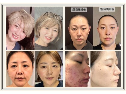 もみの樹の写真