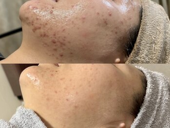 カルナ(CARNA)/【艶玉肌フェイシャル】セルマン