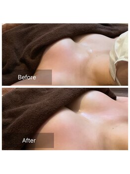 ローズボディ 恵比寿店/小顔キャビで、バストアップ☆