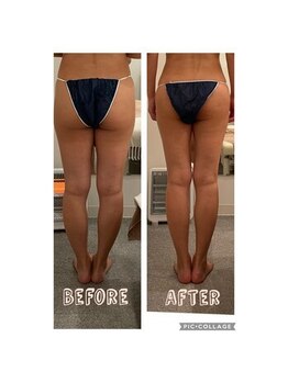 いおり骨盤整体 リブート(RE:BOOT)/セレクト痩身