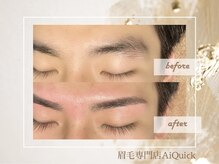 アイクイック 原宿(Ai Quick)/メンズ/眉毛ワックス/アイブロウ