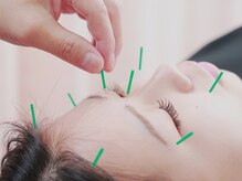 真心堂(sinsindo)の雰囲気（美容鍼）