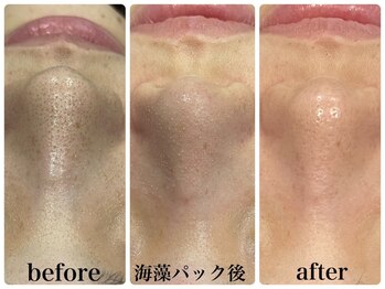 サロン ラズリ 久留米店(SALON Lazuli)/【毛穴洗浄】海藻パックで卵肌♪