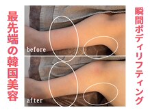 リリー(LILY)/韓国で大人気！