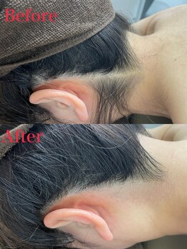 ミース 越谷店/うなじ矯正●Before After