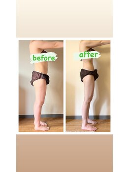 ヨサパーク マヒナ(YOSA PARK Mahina)/Before After