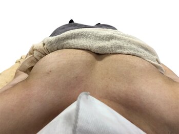 シエル(Ciel)/どっちが施術した方でしょうか！