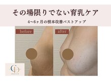 サロンドコーデ(salon de co-de)の雰囲気（脱いでも着てもキレイなバストへ！年齢は関係ナシのバストアップ）