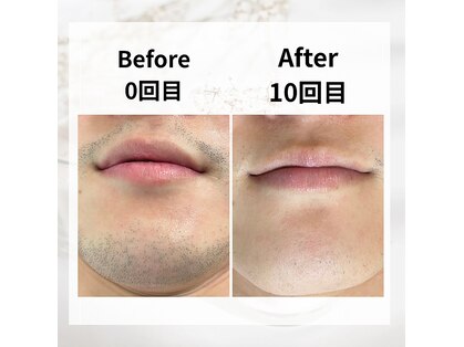 サロン ルイ(salonRui)の写真
