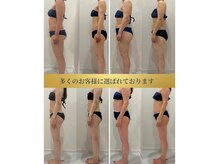 ヴィナーレ(VINARE)の雰囲気（名古屋市港区痩身/Instagramでは症例をアップしております）