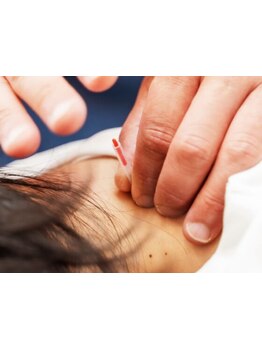 首・肩のつらさを改善したい