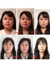 ラハイナ/回を重ねるごとに小顔が定着