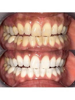 ライトビューティー 池袋店(LightBeauty)/症例写真