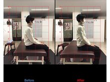 ストレチックス 近江八幡店/BeforeAfter