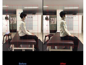 ストレチックス 近江八幡店/BeforeAfter