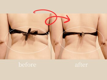 宮(Miya)/キャビラジ１回