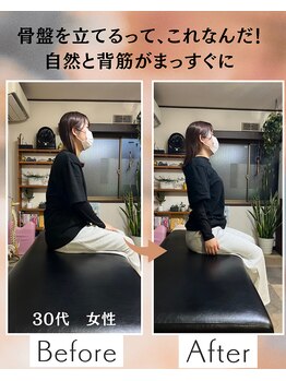 ウェルビーイング整体院 水戸赤塚店(wellbeing整体院)/Before After
