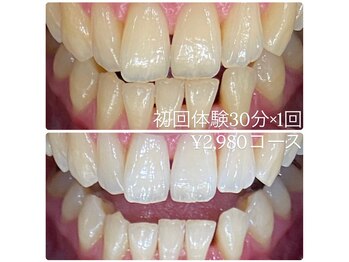 ホワイトニングルーム 横浜店(Whitening Room)/セルフホワイトニング/横浜