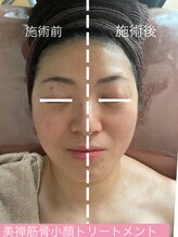 ココ 2号店(CoCo)/筋骨小顔トリートメント