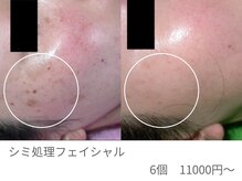 アレキサンドライト 名古屋栄店