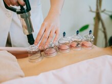 心地治療院 凪ぎのひ/吸玉の様子