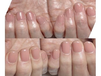 イズム(Izm)/上before/下after 約3ヶ月時点