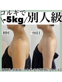 セミル(SEMIRU)/別人級コルギ