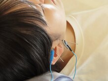 小笠原鍼灸接骨院/美容鍼［所沢/下山口］