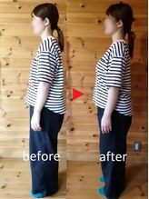 メリッサ接骨 整体院/美姿勢、お任せください！