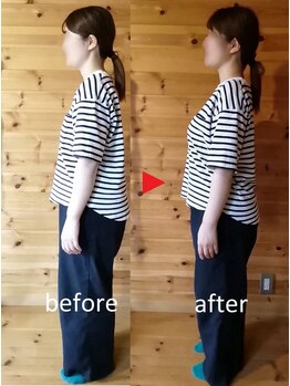 メリッサ接骨 整体院/美姿勢、お任せください!