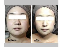 プレジール(Plaisir)の雰囲気（圧倒的な結果出しの小顔矯正）