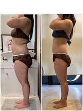 ミラヴィエ(Miravie)/レモンボトル痩身8回