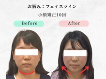 美容整体ウェリナ 中川八田院/小顔矯正/骨盤矯正/痩身整体