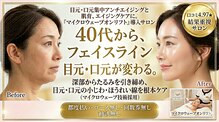 バイオ ビューティー 新潟店(Bio Beauty)