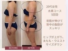 ヨサパーク すずのね(YOSA PARK)/よもぎ蒸し＋水素吸入５回目効果