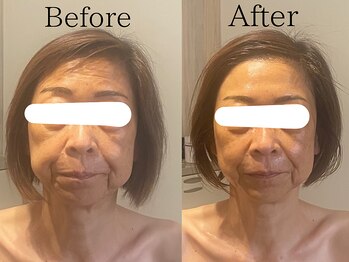 サロン ジジ(salon JiJi)/韓国小顔コルギ