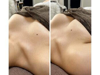 エミナル(EMINARU)/