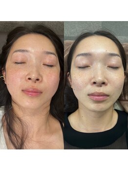 こうぞう整体院/美容鍼×筋膜リリース