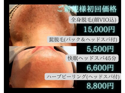ミーエイト(Mii∞)の写真