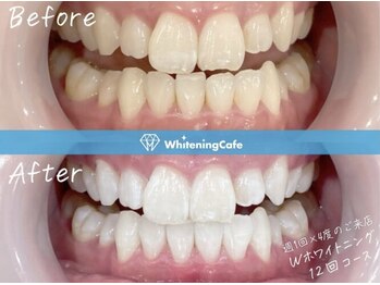 ホワイトニングカフェ イオン新潟青山店(WhiteningCafe)