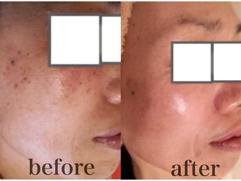 フィス エステティックサロン/40代50代と大人気☆