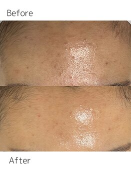 リュクス Luxe+tkm 南船場/セラピールビフォーアフター