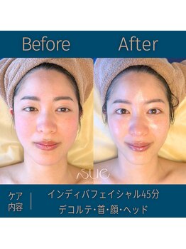 スー(Sue)/リフトアップは断然インディバ！