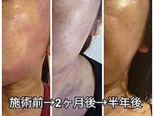 エスプリクレール(Esprit Clair)/フェイシャル～敏感肌