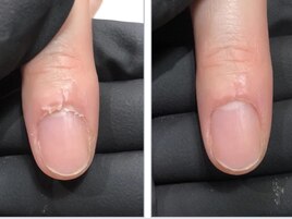 ハンドケアで脱！乾燥ささくれ！