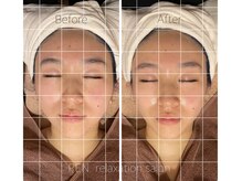 レン サロン(REN.)/整体×フェイシャル【小顔矯正】